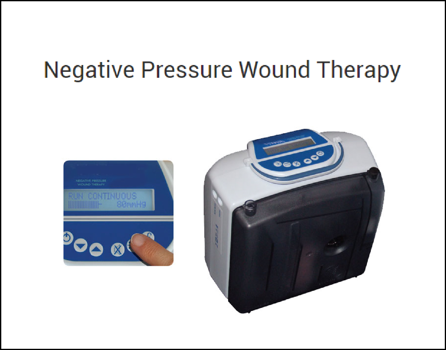 Oxygen Therapy